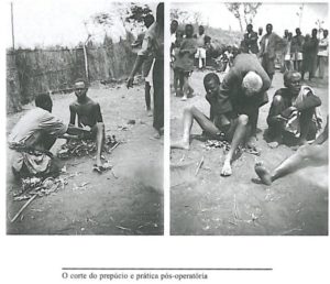 damba-circuncisao